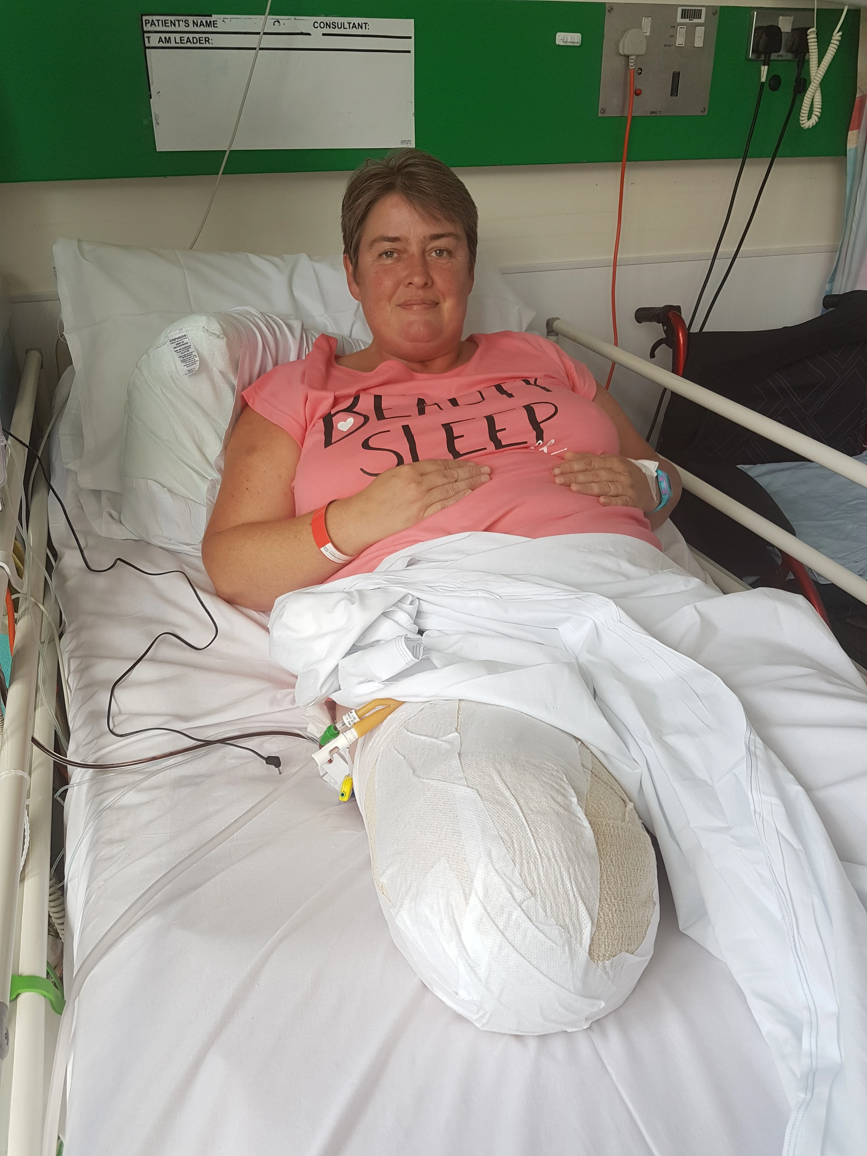 Janet In hospital just after Amputation 2017 (1)