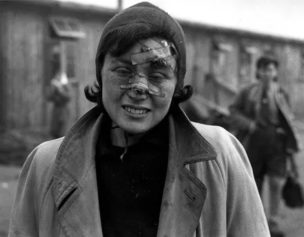 A survivor of the Bergen Belsen concentration camp